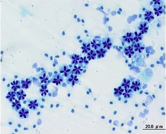 メチレンブルーで染色し顕微鏡で見た胞子